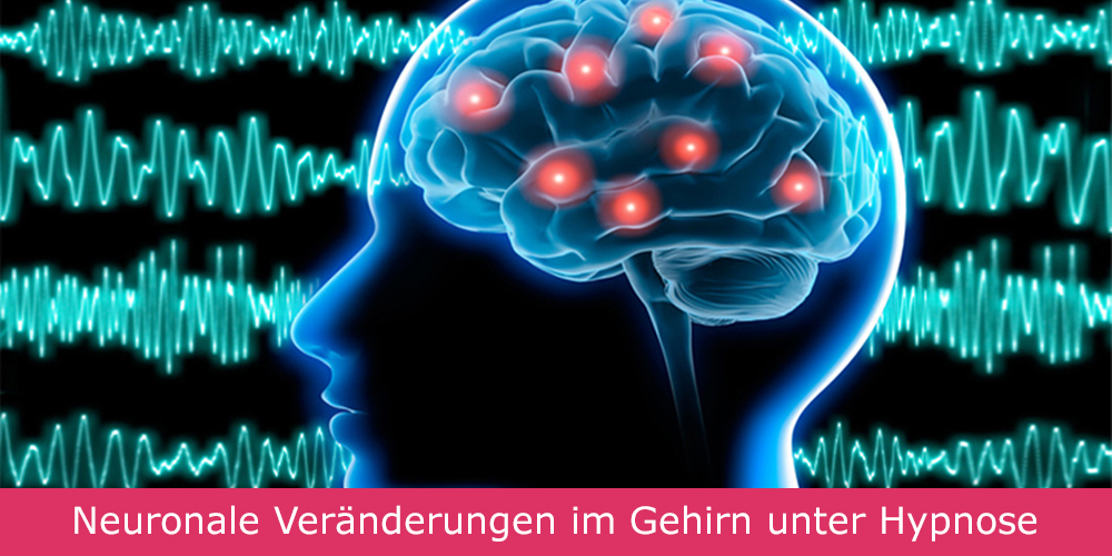 Gehirn mit Neuronen